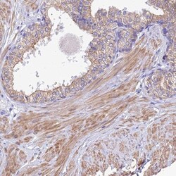 GLRA4 Antibody, Novus Biologicals 0.1mL; Unlabeled:Antibodies, Polyclonal